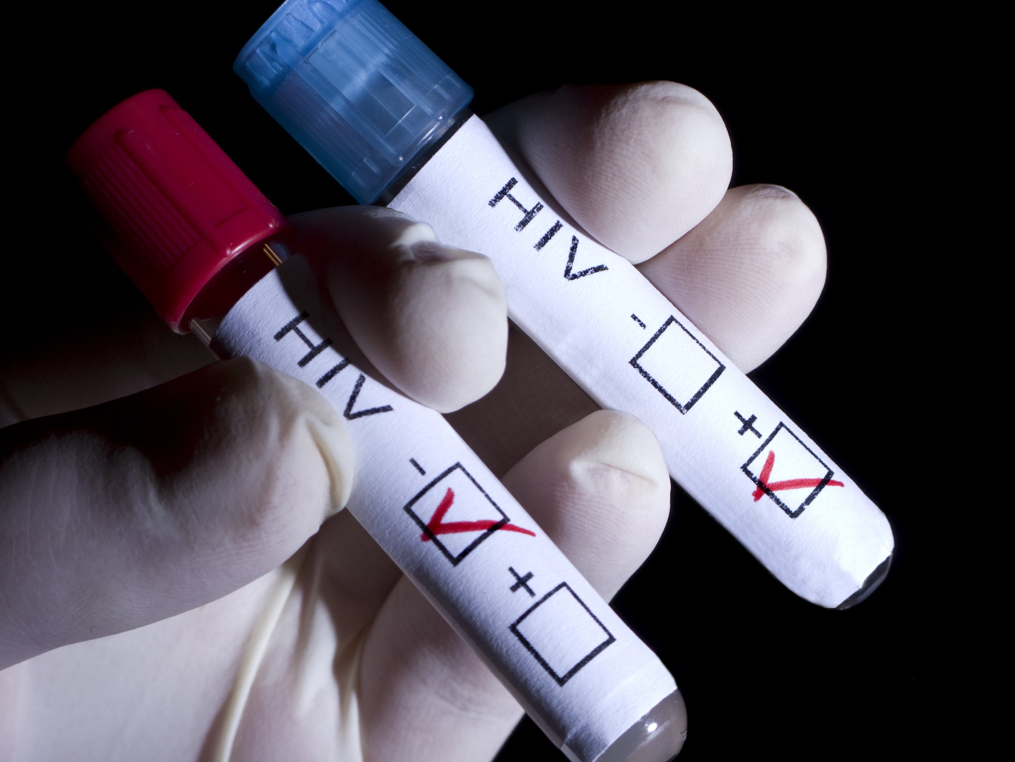 Что нужно знать о тестировании на ВИЧ?