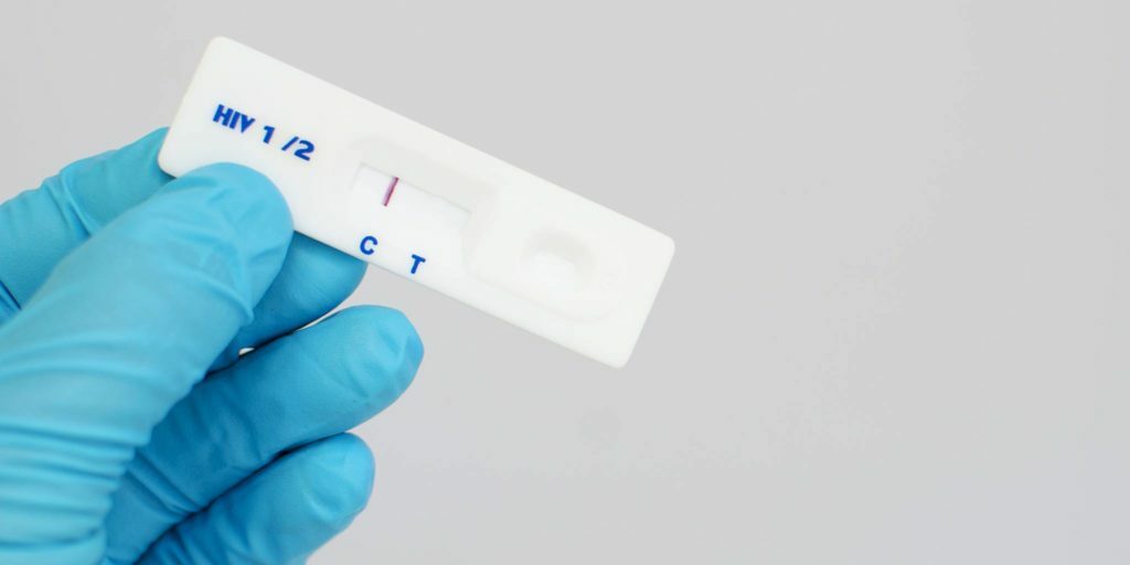 Причины ложноотрицательного теста на ВИЧ инфекцию