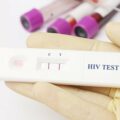 Ложноположительный результат теста на ВИЧ: причины